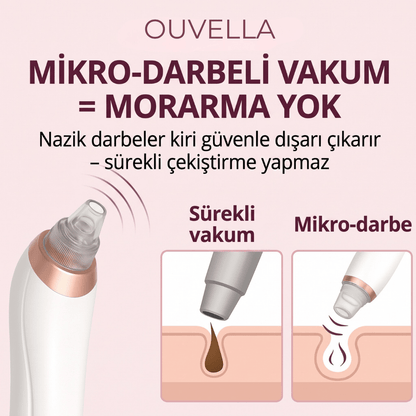 Ouvella Vakumlu Gözenek Temizleyici: Pürüzsüz Bir Cilt İçin Derinlemesine Arınma