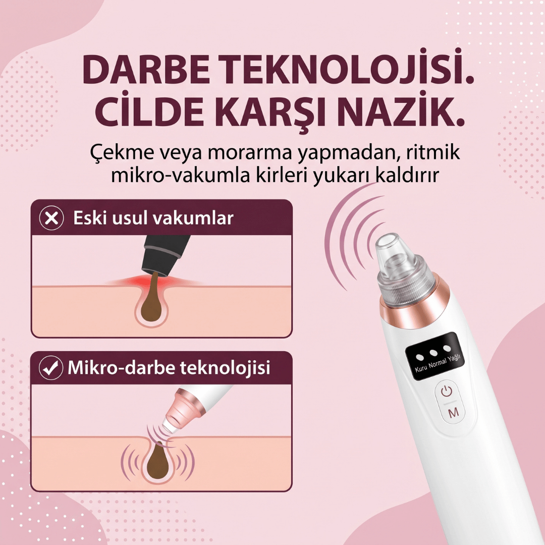 Ouvella Vakumlu Gözenek Temizleyici: Pürüzsüz Bir Cilt İçin Derinlemesine Arınma
