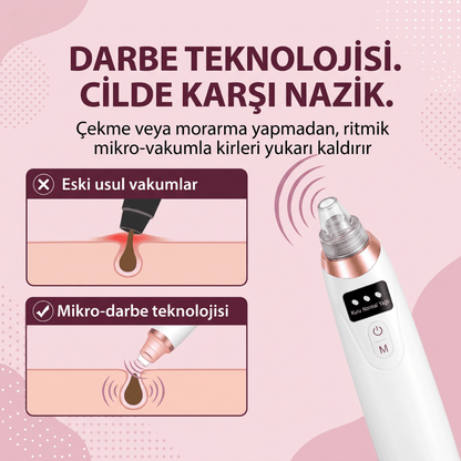 Ouvella Vakumlu Gözenek Temizleyici: Pürüzsüz Bir Cilt İçin Derinlemesine Arınma